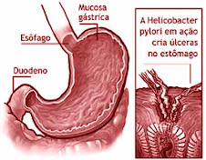 Como curar a pessoa da dependência alcoólica